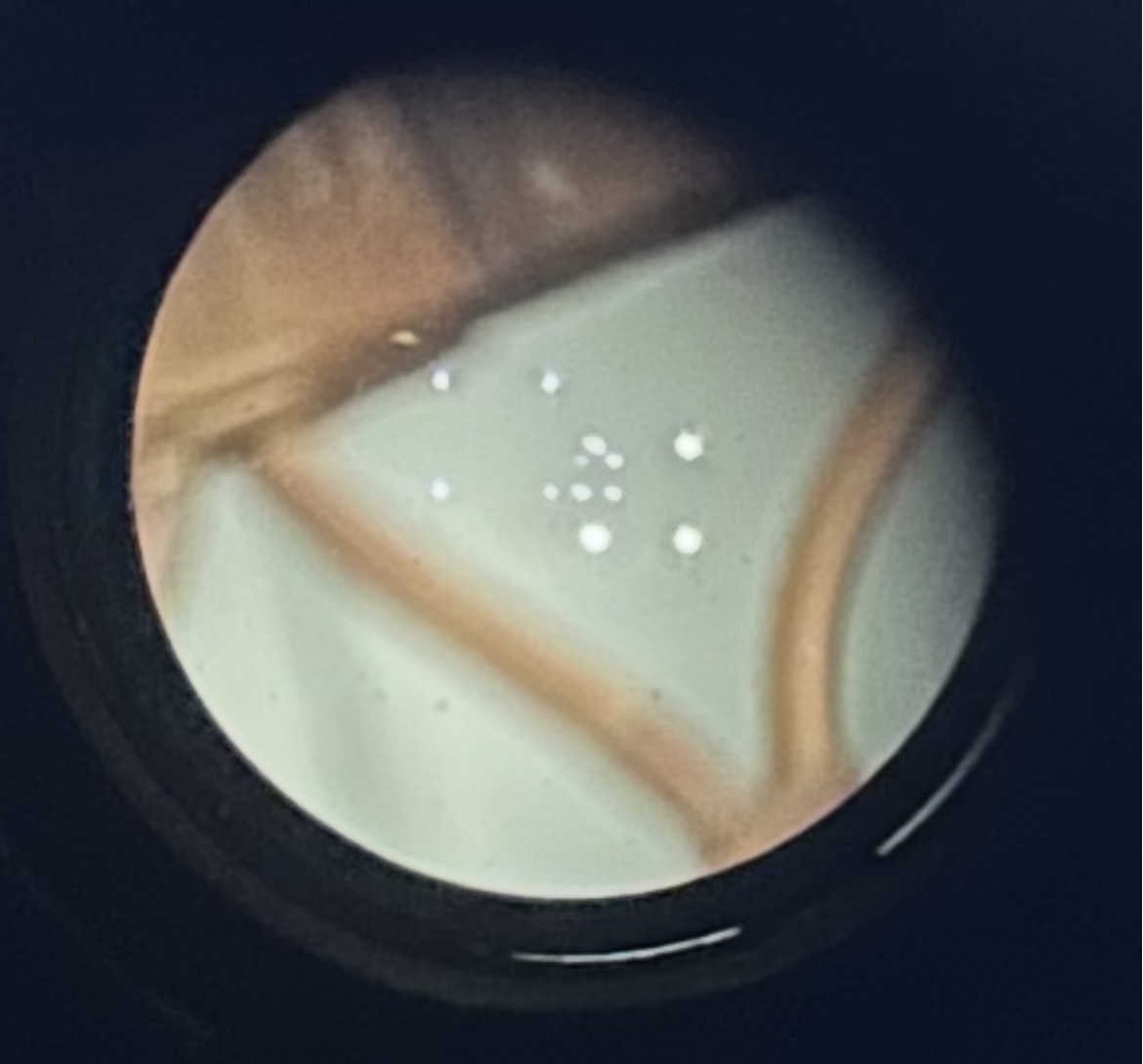 Collimateur imprimé en 3D